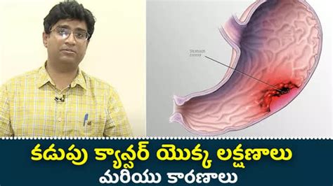 shingles in telugu|షింగిల్స్: లక్షణాలు, కారణాలు మరియు చికిత్స ఎంపికలు